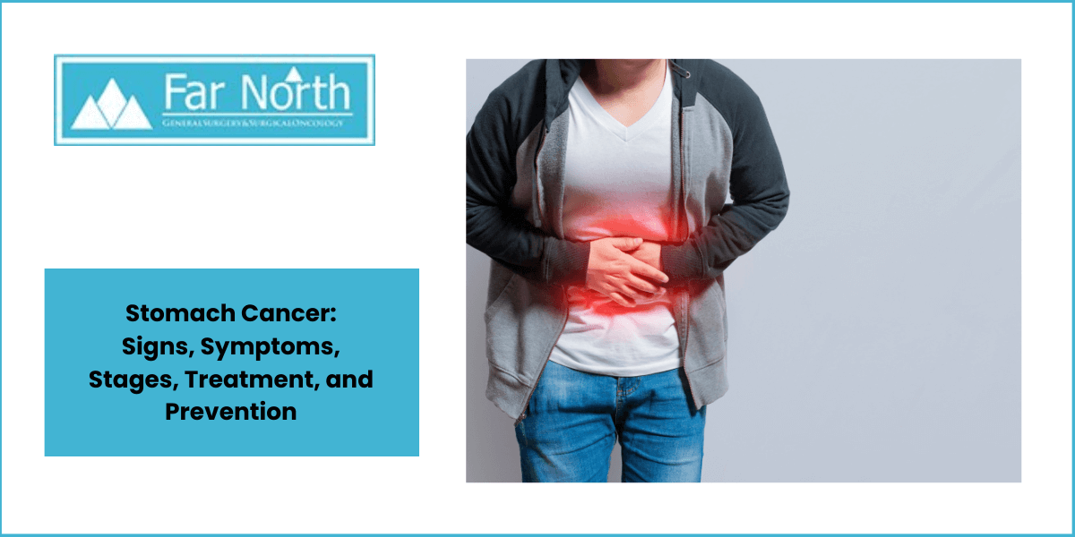 Stomach Cancer Signs Symptoms Stages Treatment And Prevention