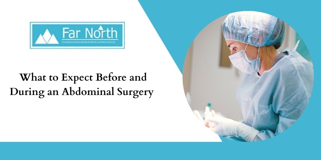 What to Expect Before and During an Abdominal Surgery